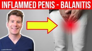 The infection causes burning and pain in the penis