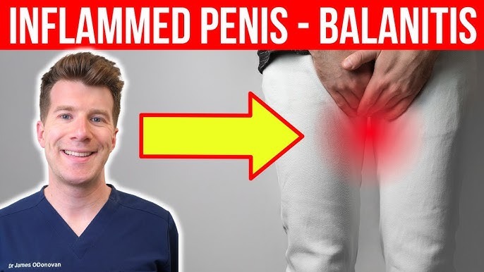 The infection causes burning and pain in the penis